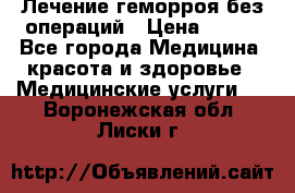 Лечение геморроя без операций › Цена ­ 300 - Все города Медицина, красота и здоровье » Медицинские услуги   . Воронежская обл.,Лиски г.